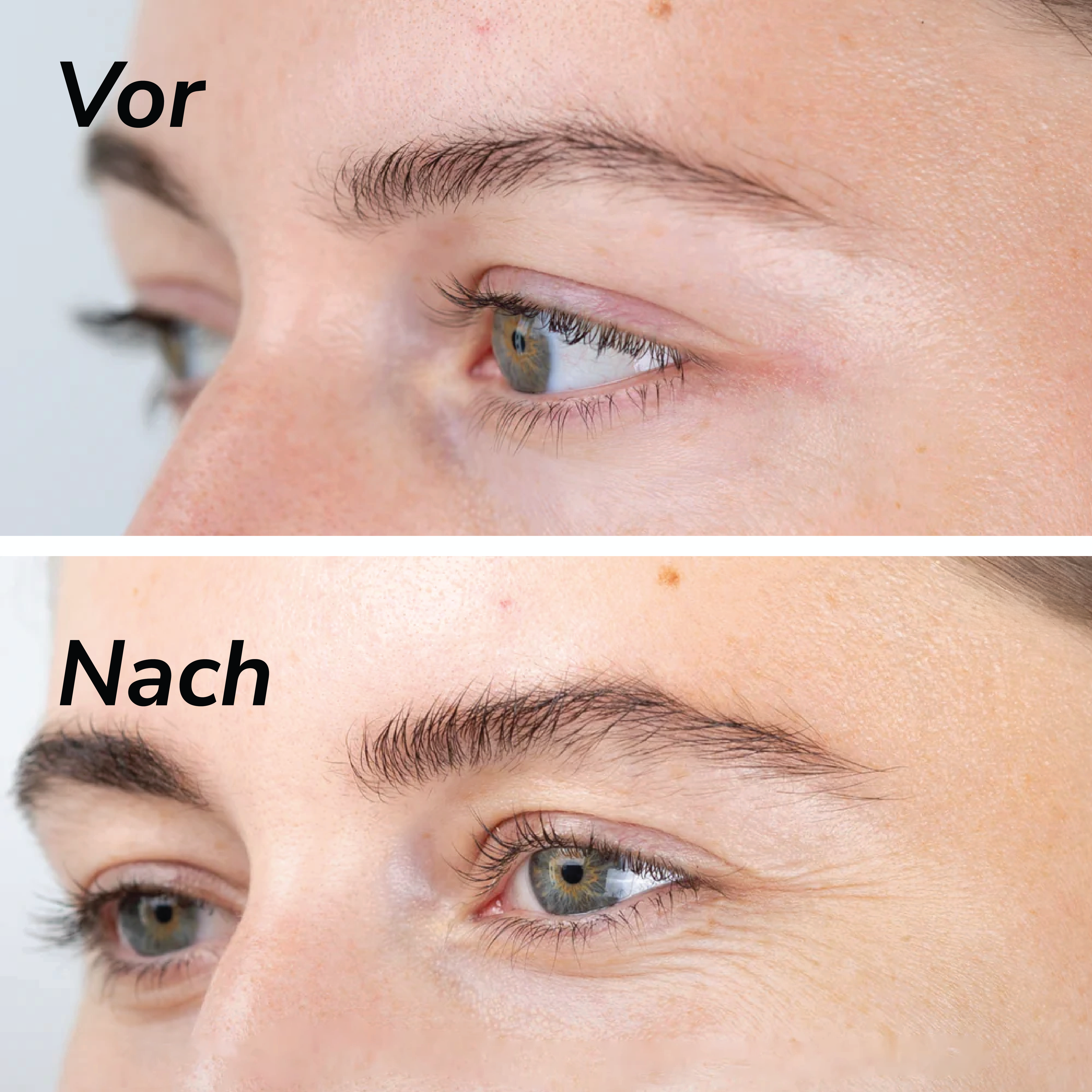 Eyebrow Growth Serum