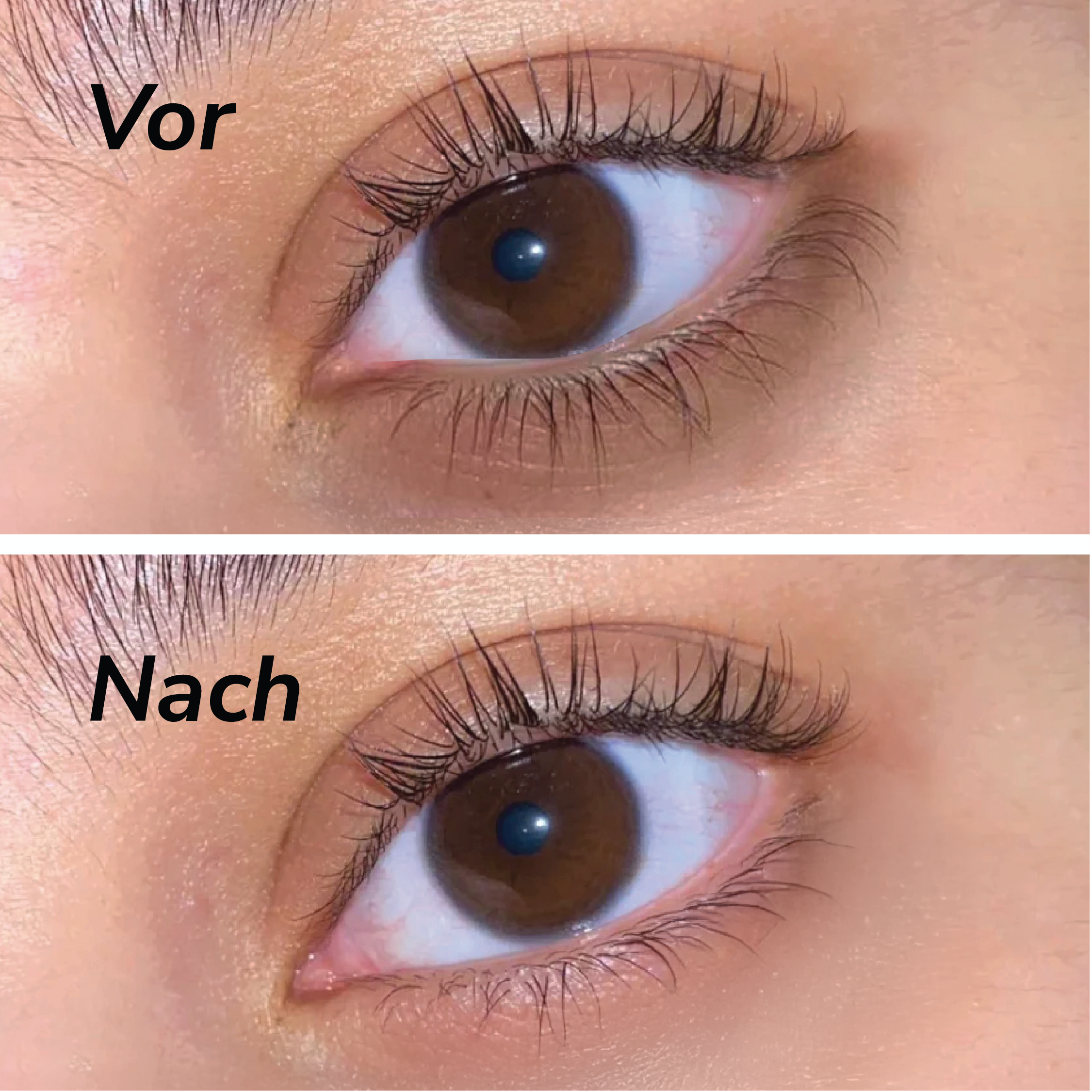 Teré Eye Treatment Serum