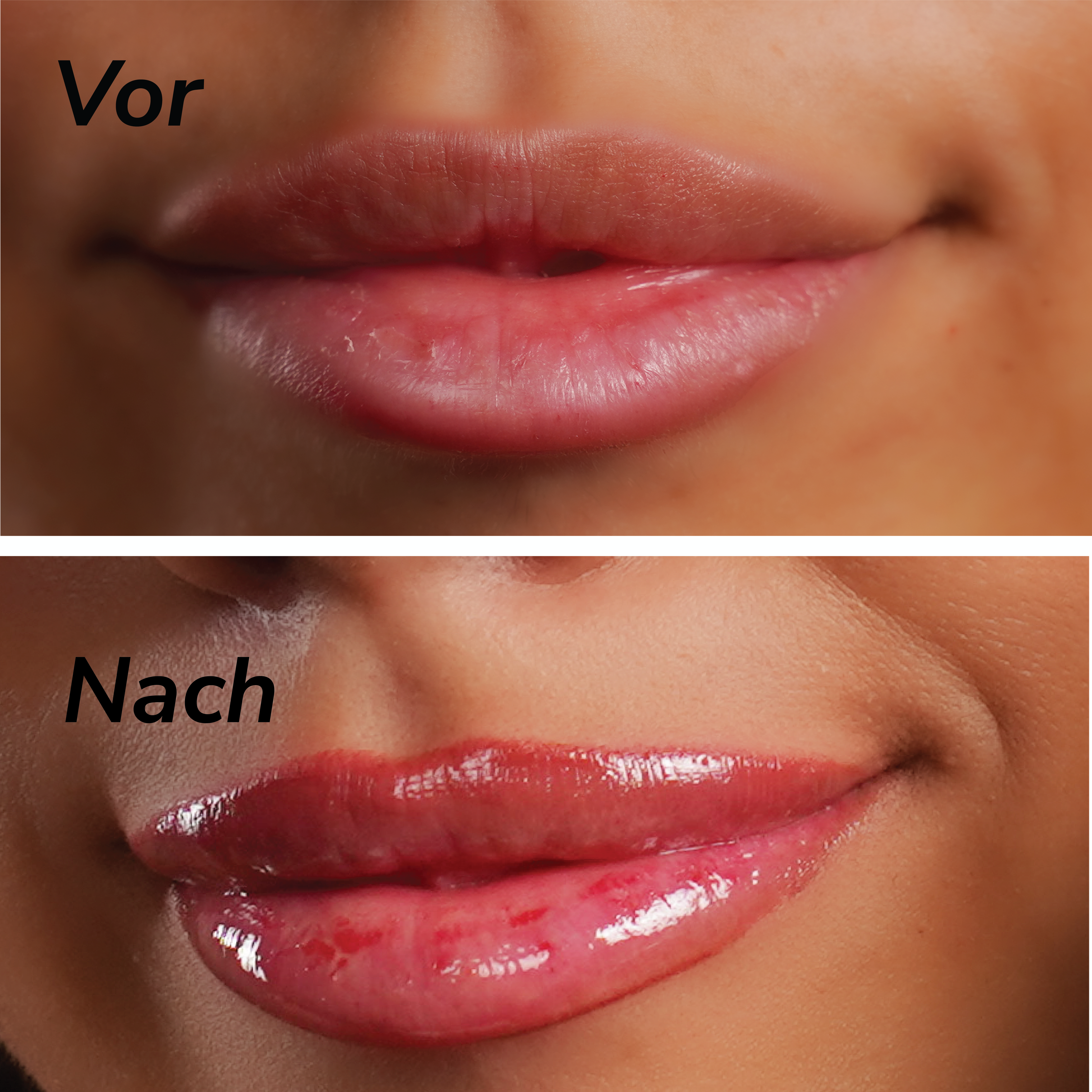 Teré Lip Treatment Serum